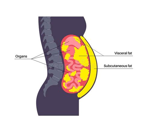 fat gi|picture of visceral fat.